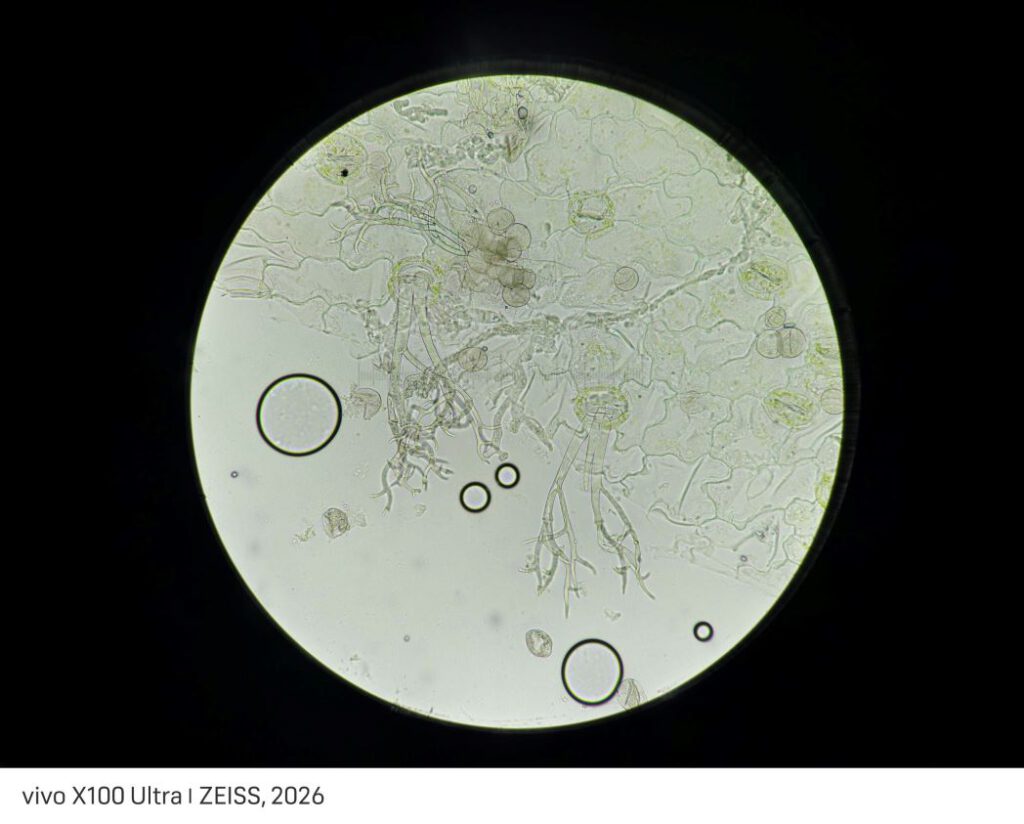 Peronospora ficariae
